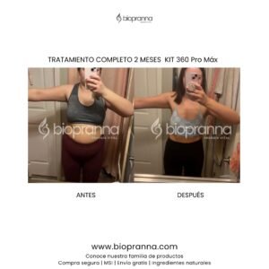 antesydespuésweb101