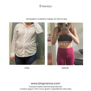 antesydespuésweb103