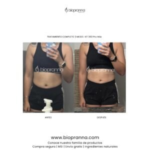 antesydespuésweb109