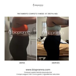 antesydespuésweb114