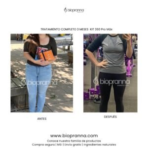 antesydespuésweb115