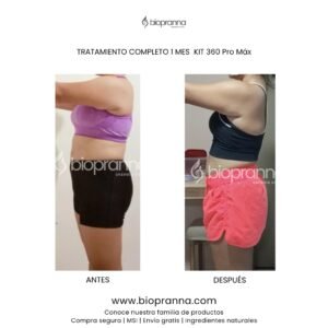 antesydespuésweb118